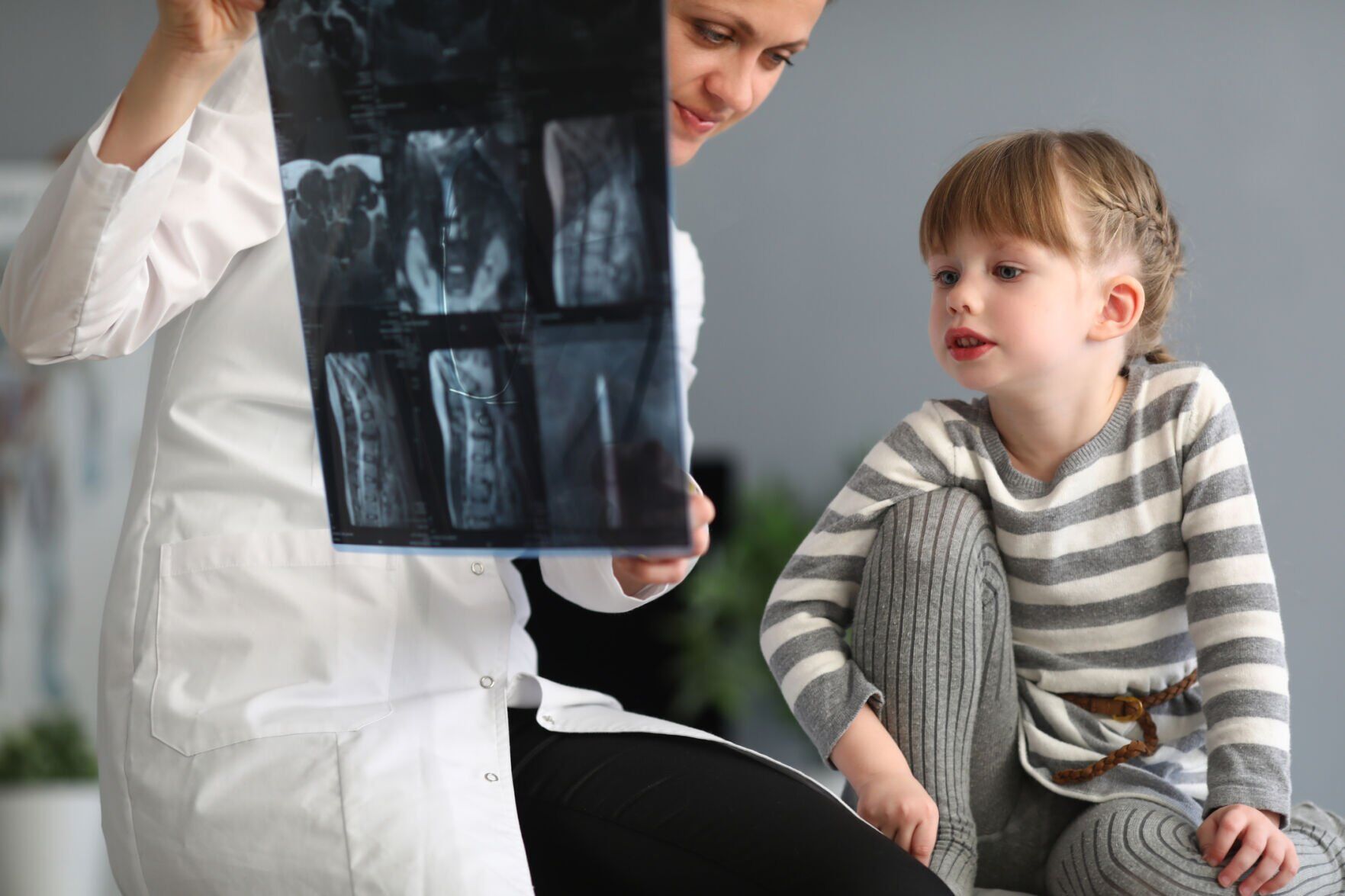 mayo-scoliosis-20211118
